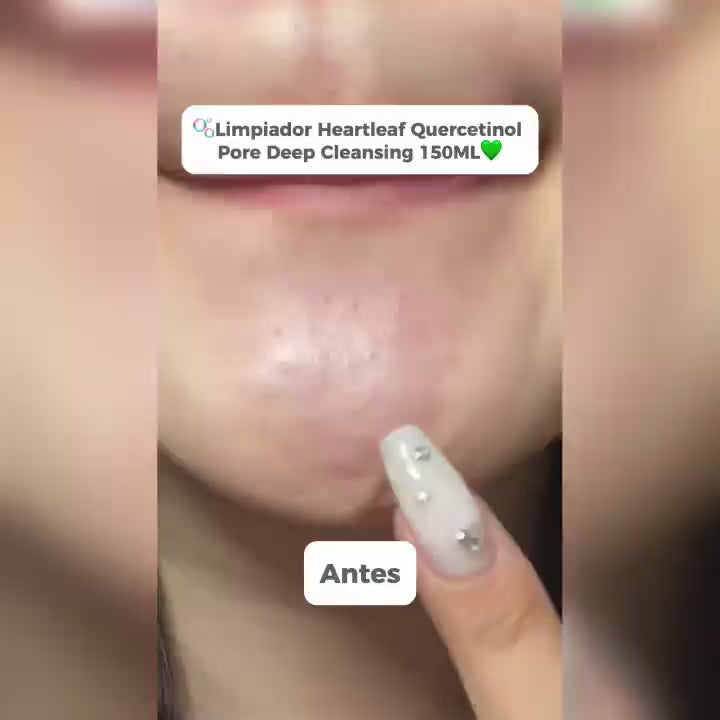heartleaf pore deep cleansing anua