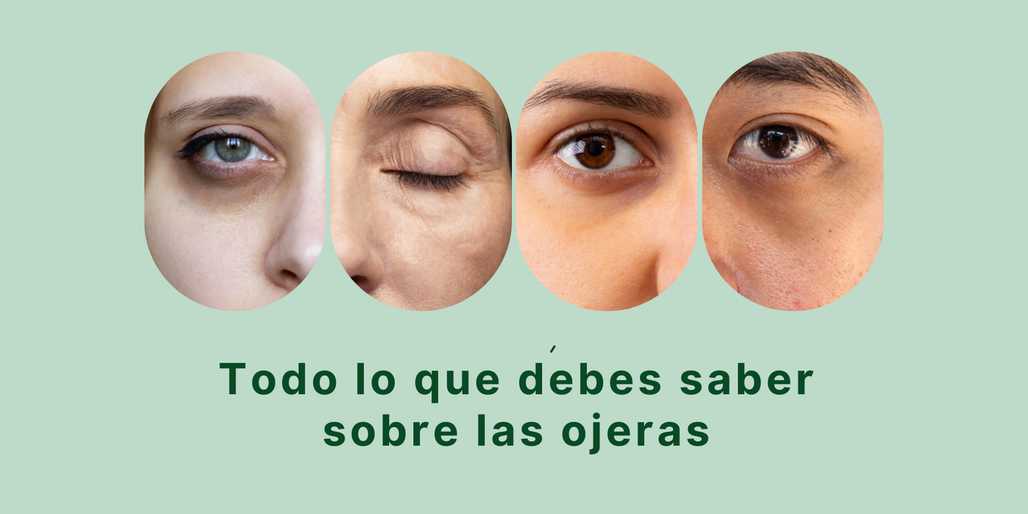 causas de las ojeras