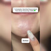 heartleaf pore deep cleansing anua