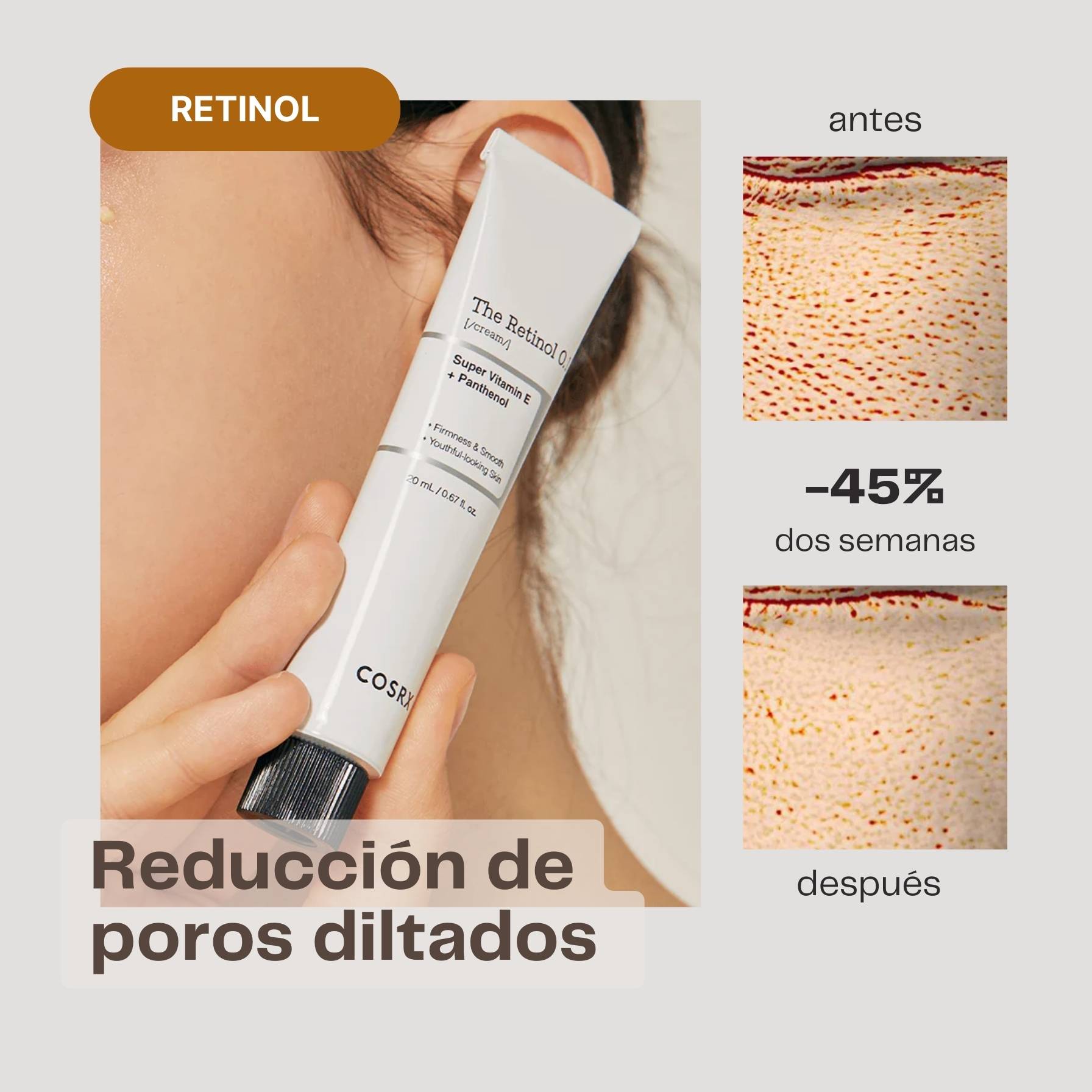 retinol poros y acne